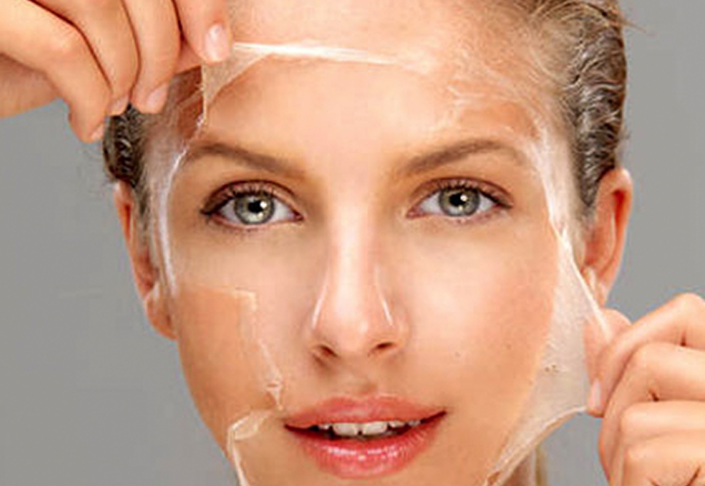 Chemical Peel Treatment