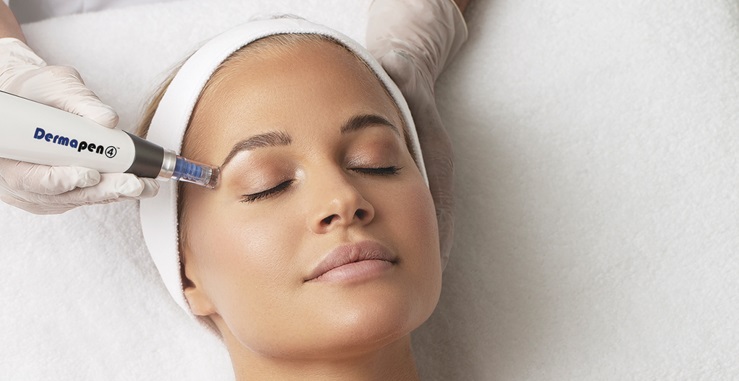 Microneedling Treatment